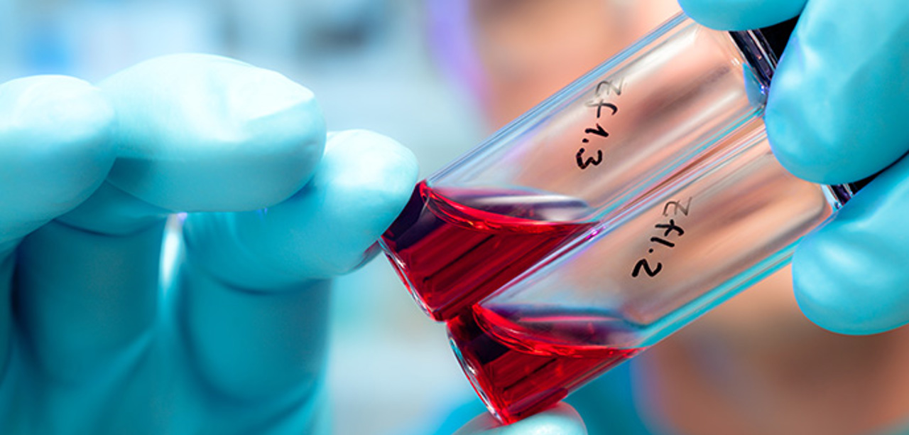 A vial with red liquid is handled by a lab technician in blue surgical gloves.